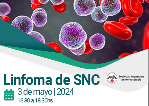 Linfoma de SNC